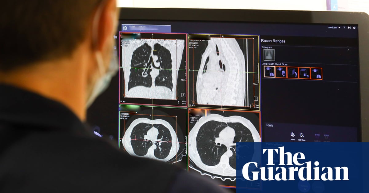 The UK can expect a 'tsunami of missed cancers' in the wake of the pandemic, experts say | Cancer